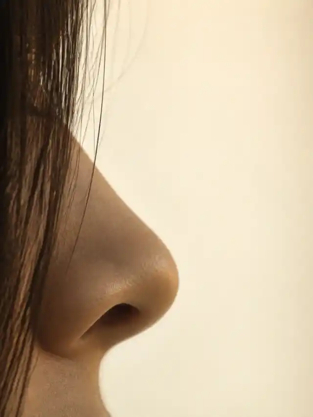 Bella Hadid Before and After Nose Job Story
