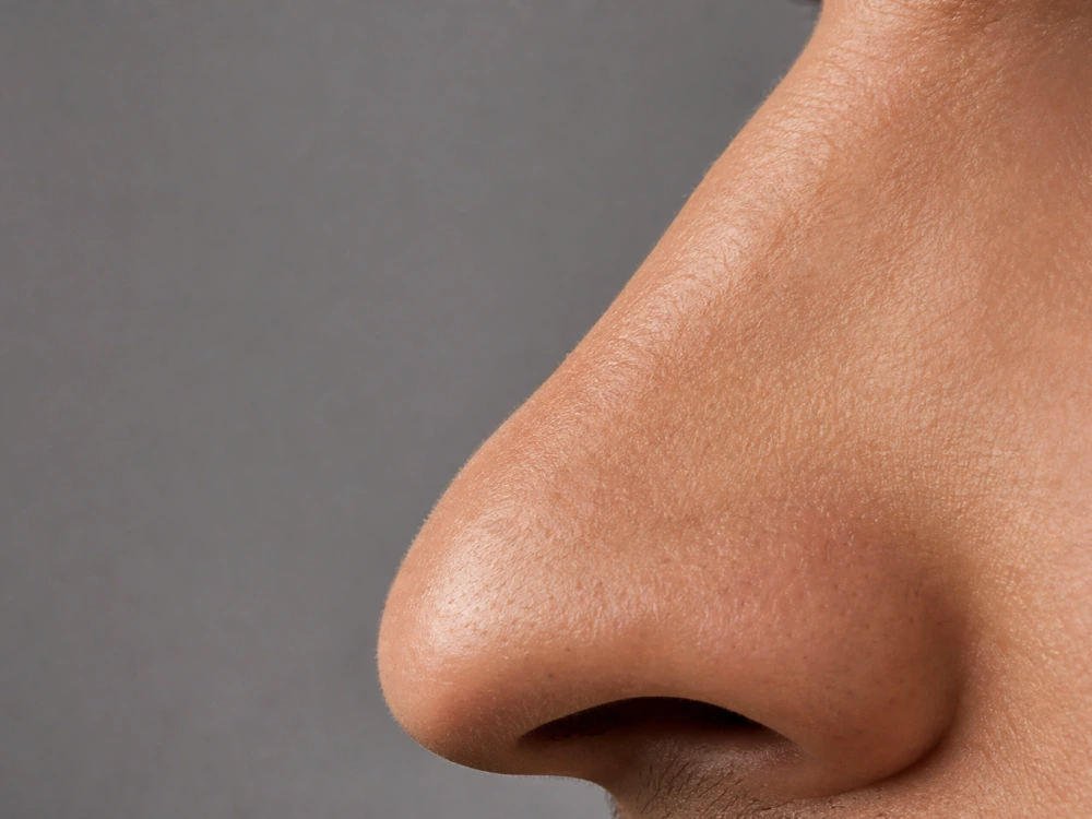 Side profile comparison illustrating Drake nose job rhinoplasty speculation