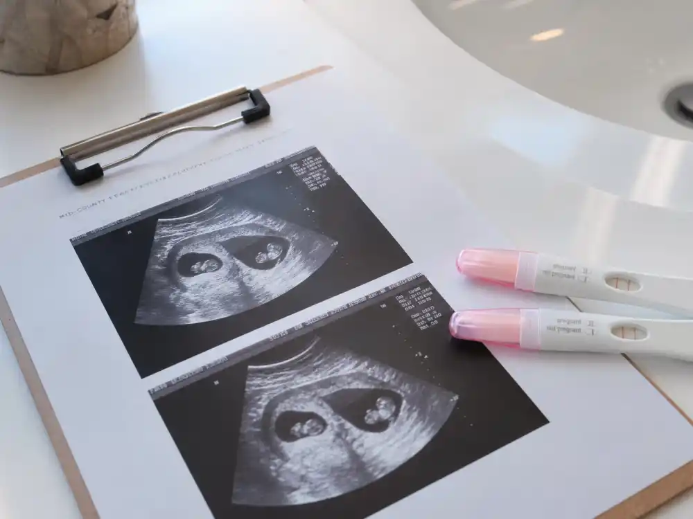 Ultrasound and pregnancy tests for Ashley Graham baby announcement 2025 twins chapter — September 2021 surprise that she was carrying two boys