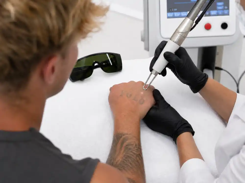 Zac Efron tattoos and their meanings — laser tattoo removal session on faded YOLO hand lettering in clinical dermatology setting